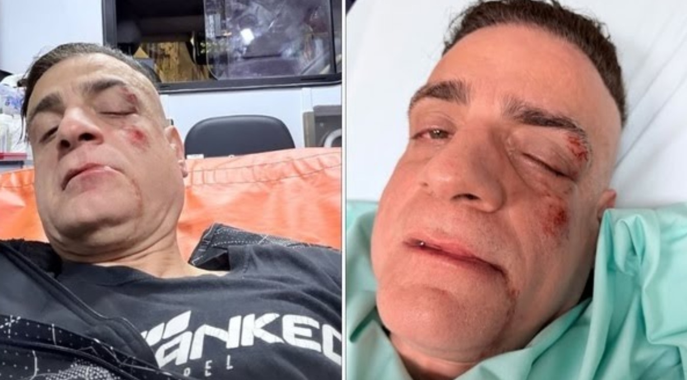 YouTuber Cicalone attacked in Rome by criminal gang. Image credit: X.com