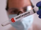 Hantavirus test results returned negative for all isolated cases.