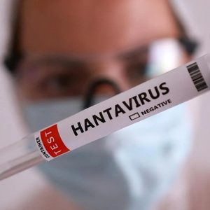 Hantavirus tests in Italy come back negative Hantavirus test results returned negative for all isolated cases.