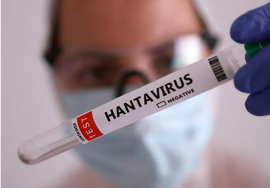 Hantavirus test results returned negative for all isolated cases.